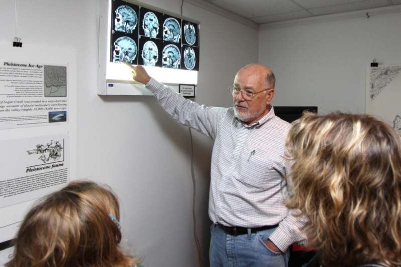 a man pointing at x-ray image on a white wall