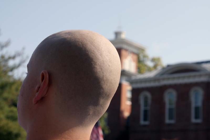 a bald head with a building in the background